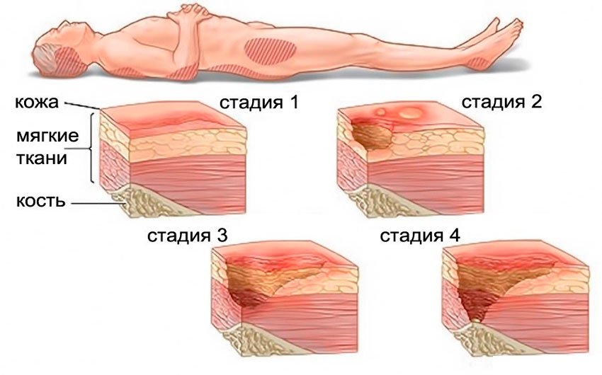 Классификация